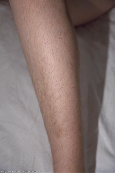 [Image: 128964683_0056.jpg]